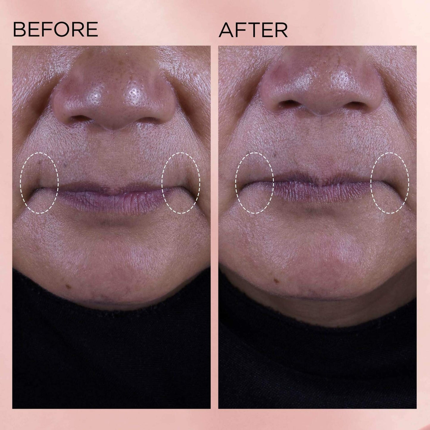 Retinol + HPR Ceramide Rapid Skin-Renewing Water Cream