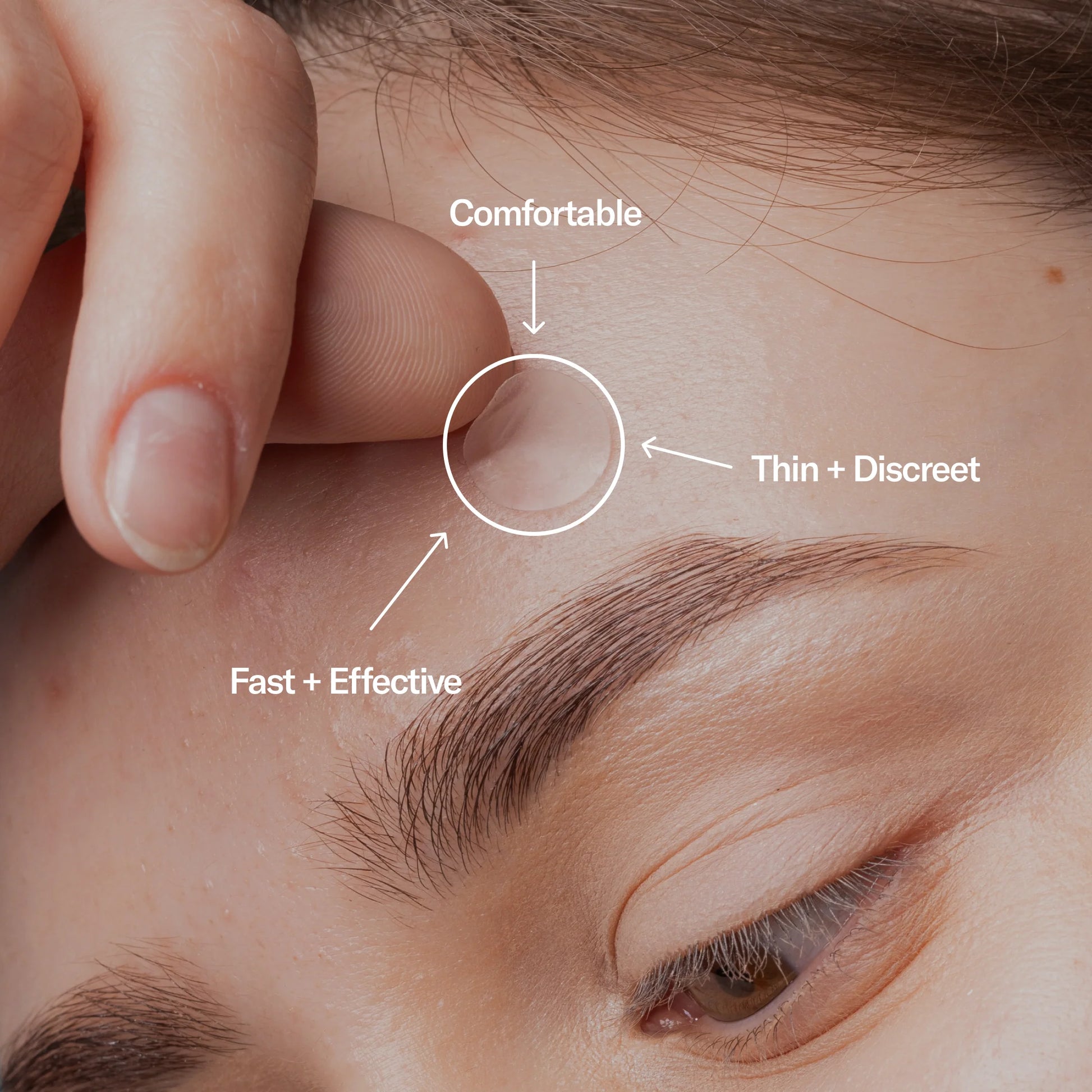 Zit Zapper Pimple Patches