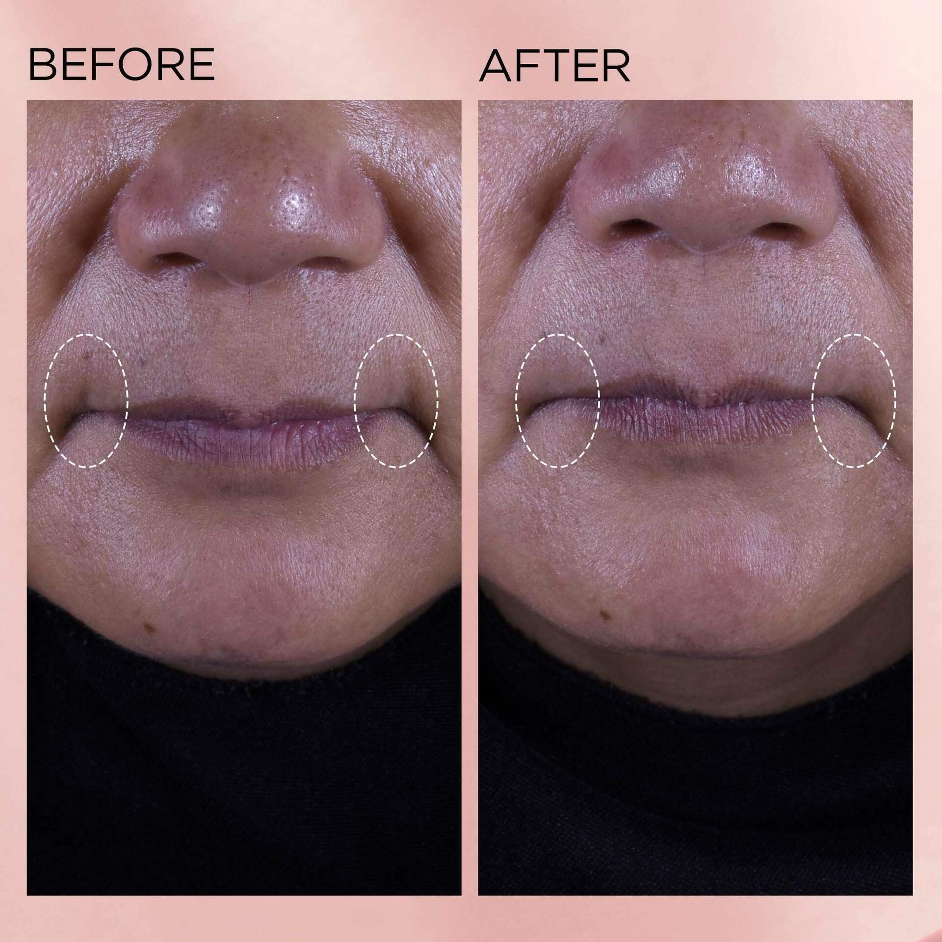 Retinol + HPR Ceramide Rapid Skin-Renewing Water Cream